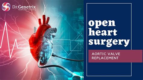 Aortic Valve Replacement Surgery Open Heart Surgery ️ Youtube