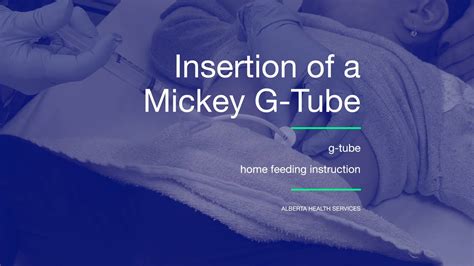 Insertion Of A Mickey G Tube On Vimeo