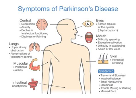 Faqs On Parkinsons Disease Hosiped