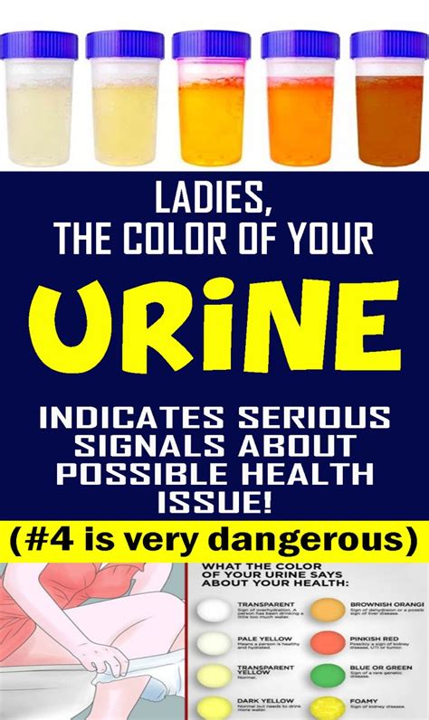 Pin By Emily On Hhmmm Health Frequent Urination Remedies