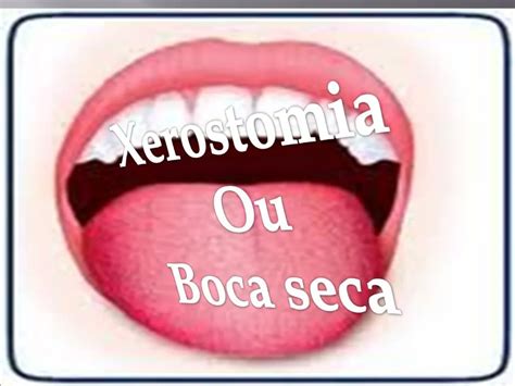 Ppt Xerostomia Ou Boca Seca Powerpoint Presentation Free Download