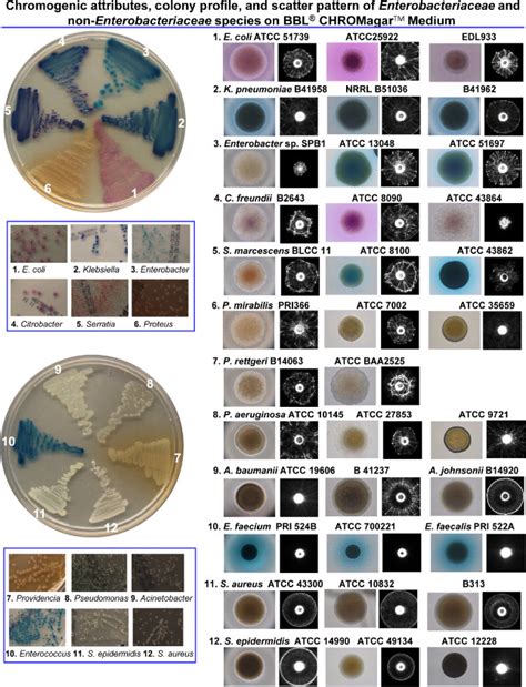 Bacterial Colony Colour And Scatter Pattern On Chromagartm Orientation