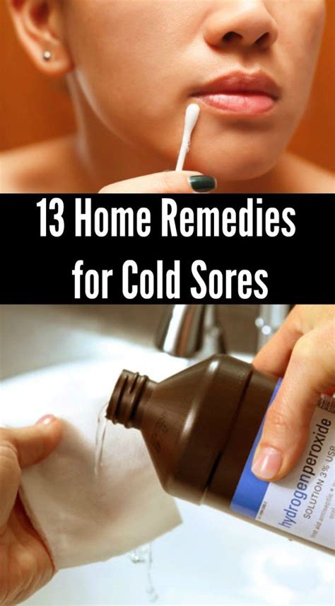 13 Home Remedies For Cold Sores Cold Home Remedies Cold Sore Cold