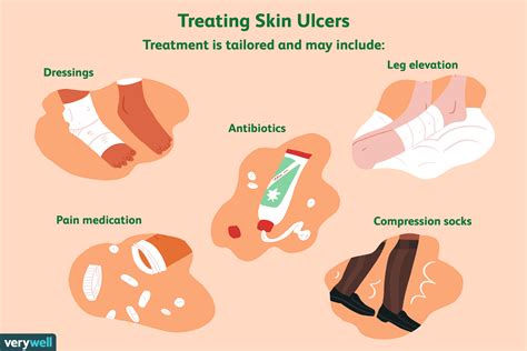 Skin Ulcers Symptoms Causes Diagnosis And Treatment