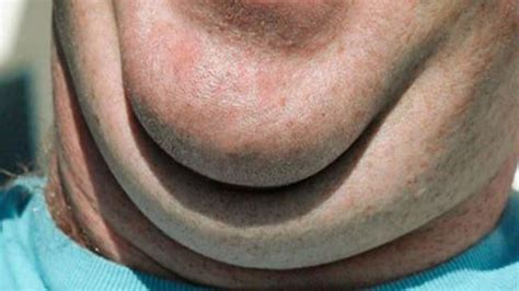 A Few Easy Things You Can Do To Tame That Persistent Double Chin Gma