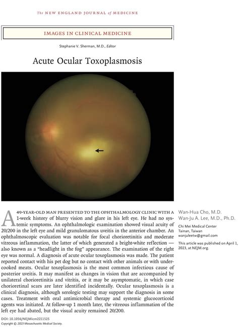 Mauricio Ambriz On Twitter Toxoplasmosis Ocular Aguda N Engl J Med Doi