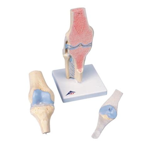 Sectional Knee Joint Model A89 Anatomical Parts And Charts