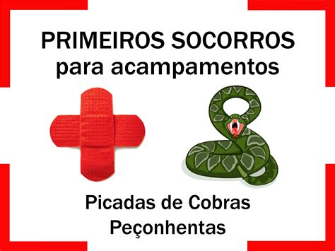 Atos 28 Picada Da Cobra Explicação