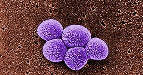 American Homes Harbor Antibiotic Resistant Superbug Mrsa Cbs News