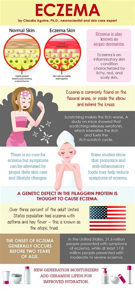 Eczema Infographics — You Must Read To Stop The Suffering From Eczema