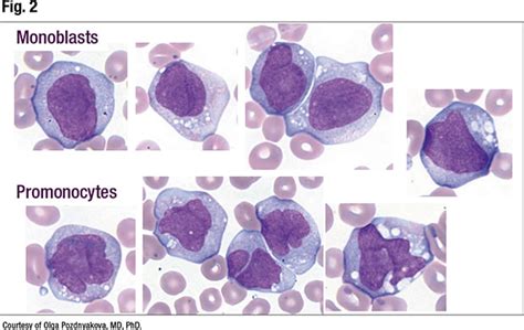 Monocytes And Lymphocytes