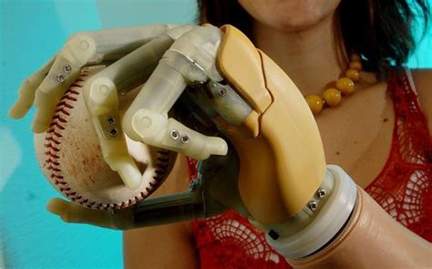 Woman Wants Her Hand Cut Off And Replaced With Bionic Limb