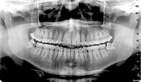 Diagnoimagen Radiología Dental