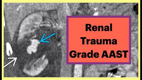 Renal Trauma Injury Grade Aast Radiology Urology Kidney Youtube