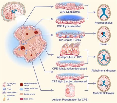 Frontiers Choroid Plexus Epithelium And Its Role In Neurological Diseases