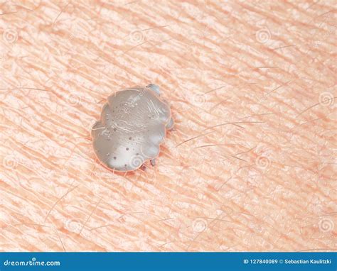 Scabies Cartoons Illustrations And Vector Stock Images 299 Pictures To