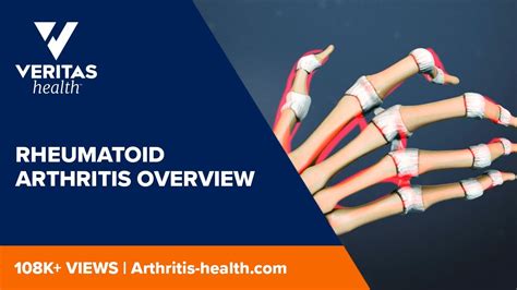 Rheumatoid Arthritis Overview Youtube