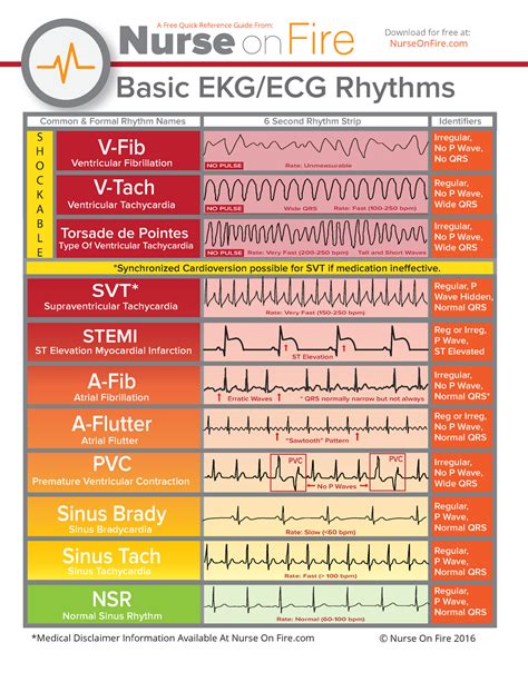 Basic Ekg Ecg Rhythms Cheatsheet Copy Basic Ekgecg Rhythms V Fib V