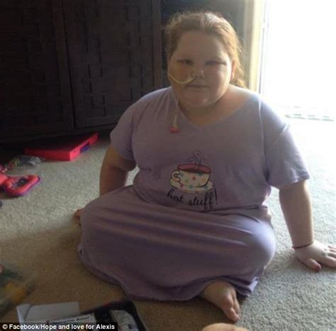 Texas Year Old With Metabolic Disorder Lost Lbs After Gastric