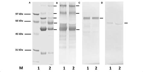 Sds Gel Electrophoresis And Western Blotting For The Demonstration Of