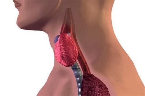 Tiroiditis De Hashimoto En Ni Os Causas S Ntomas Y Tratamiento Hot Sex Picture