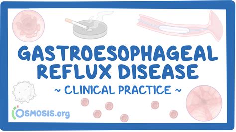 Gastroesophageal Reflux Disease Clinical Sciences Osmosis Video Library