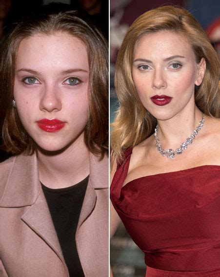 Scarlett Johansson Plastic Surgery Before And After Vrogue Co