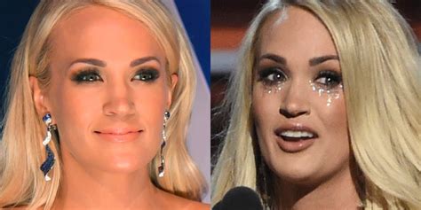 Carrie Underwood Shaken After Fall Terrified Of Fans Seeing Her