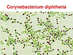 All About Difteri Difteri Disebabkan Oleh Bakteri Corynebacterium