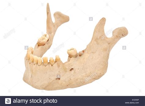 Upper Jaw Bone High Resolution Stock Photography And Images Alamy