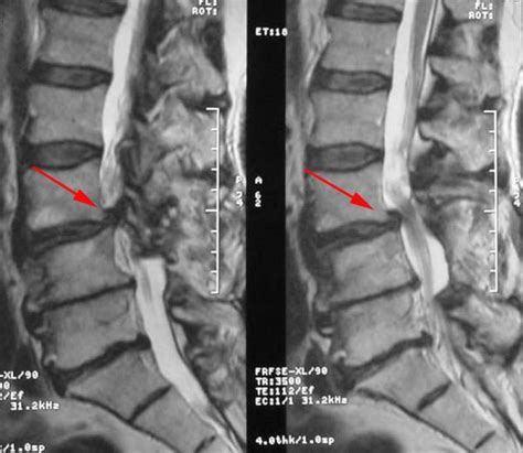 Mrt bilder anschauen und beurteilen? Prof. Dr. Christian Woiciechowsky - Neurochirurgie Berlin ...