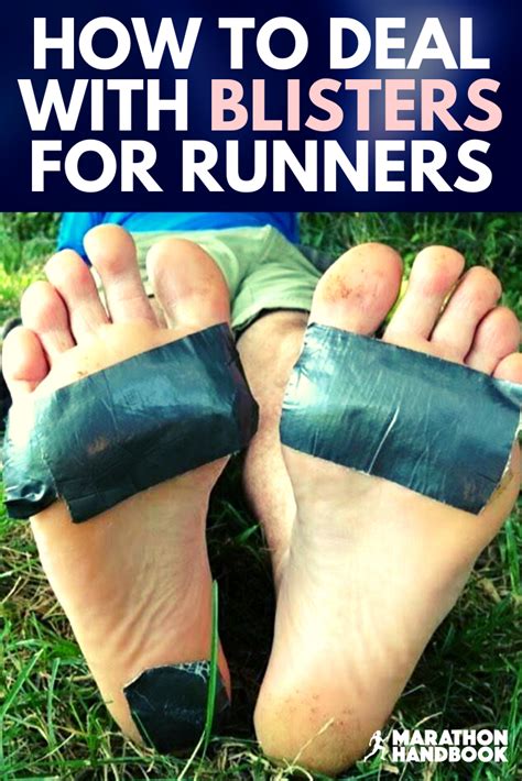 Blisters For Runners How To Prevent And Treat Them Running Blisters How To Heal Blisters