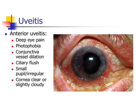 Ppt The Differential Diagnosis Of The Red Eye Powerpoint Presentation