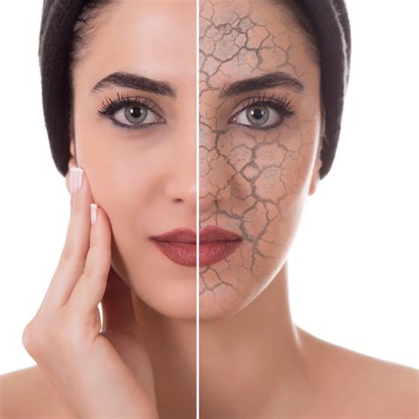 Dermatologist Tips For Dry Winter Skin Reston Dermatology Cosmetic