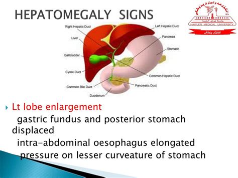 Ppt Radiology Of Hepatobiliary Systrem Pancreas And Spleen