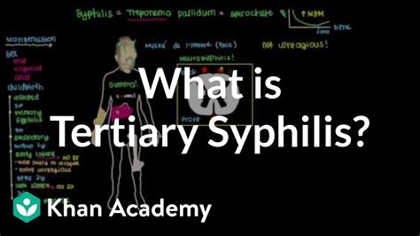 What Is Tertiary Syphilis Infectious Diseases Nclex Rn Khan