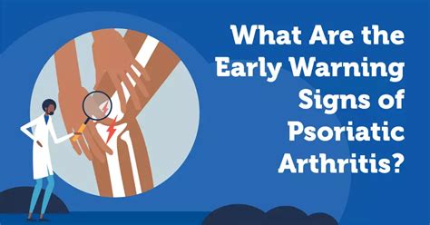 What Are The Early Warning Signs Of Psoriatic Arthritis Mypsoriasisteam