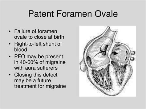 Ppt Migraine Prophylaxis In Patients With Patent Foramen Ovale