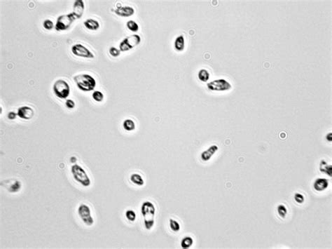 Cryptococcus Laurentii Viticulture And Enology