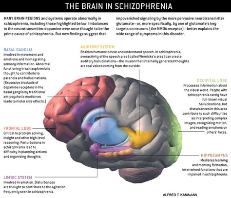 Schizophrenia Summing It Up Emotion Brain And Behavior Laboratory