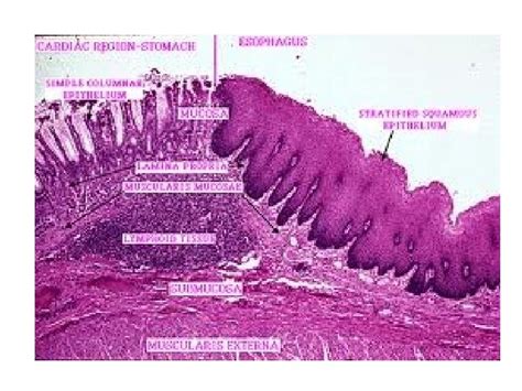 Histology Of Esophagus Gastro Esophageal Junction By Dr