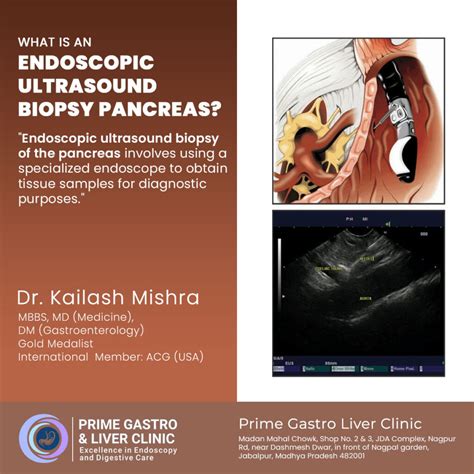 What Is An Endoscopic Ultrasound Biopsy Pancreas