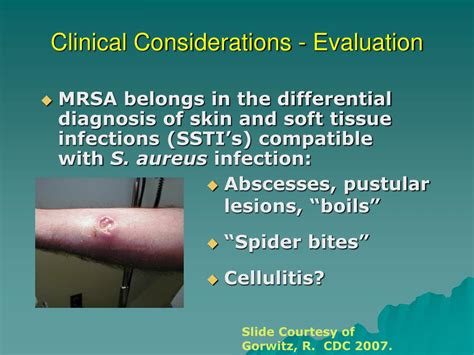 Ppt Ca Mrsa What You Need To Know Powerpoint Presentation Free