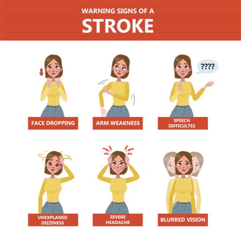 How To Recognize Stroke Symptoms And What You Should Do Szquman