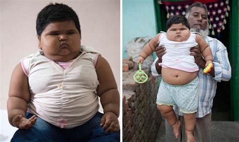Morbidly Obese Toddler Weighing 3st 11lbs Is One Of Heaviest Girls Of