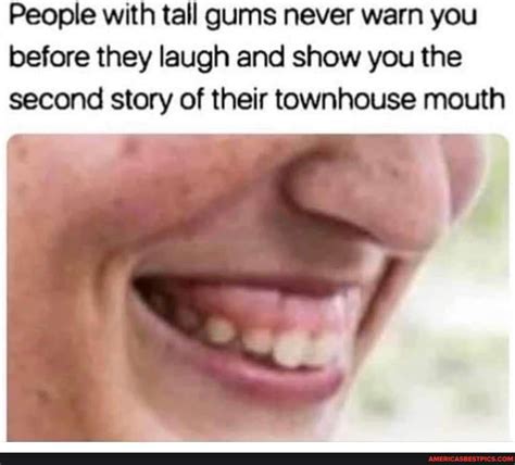 People With Tall Gums Never Warn You Before They Laugh And Show You The