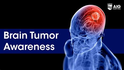 Brain Tumor Know Your Warning Signs Aig Hospitals Youtube