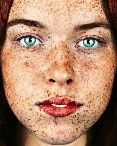 The Beauty Of The Freckles By The Photographer Brock Elbank Freckles Girl Freckles Beautiful