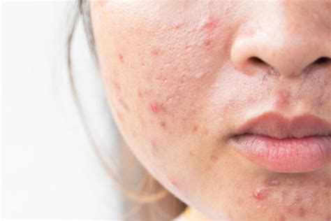 What Are The Most Common Skin Conditions That Get Diagnosed Today