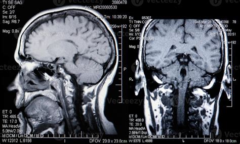 Real Mri Scans Of The Head And Brain Stock Photo At Vecteezy